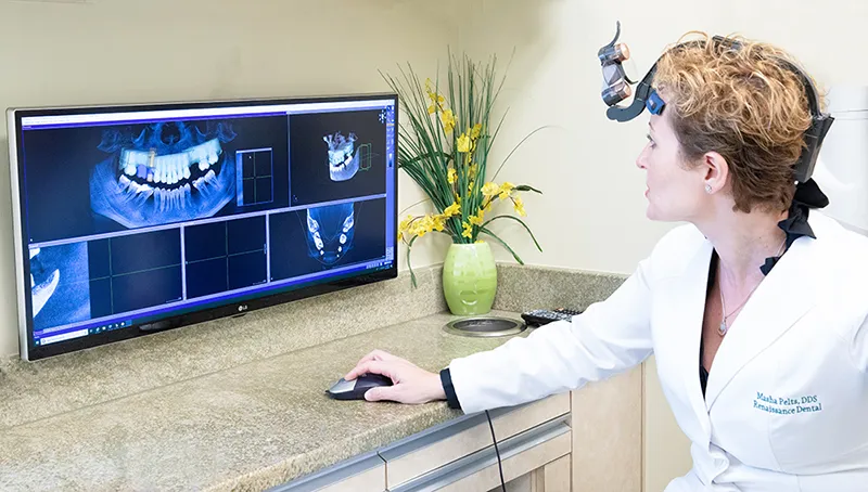 CBCT