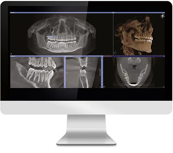 imagecbct