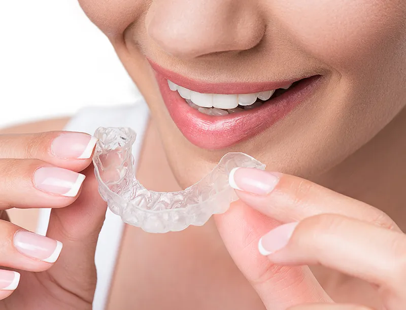 invisalign